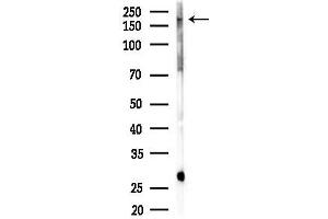 anti-Nebulin Related Anchoring Protein (NRAP) antibody