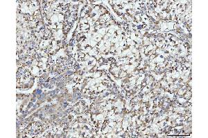 IHC analysis of ECSIT using anti-ECSIT antibody (ABIN7602543).
