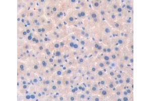 Used in DAB staining on fromalin fixed paraffin- embedded liver tissue (TSSK1 抗体  (AA 57-314))