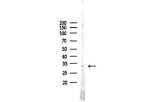 anti-NK6 Homeobox 3 (NKX6-3) (Internal Region) antibody