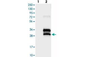 Western blot analysis of Lane 1: Negative control (vector only transfected HEK293T lysate), Lane 2: Over-expression Lysate (Co-expressed with a C-terminal myc-DDK tag (~3. (BRICD5 抗体)