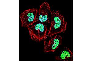 Fluorescent confocal image of Hela cell stained with ZN Antibody (C-term) (ABIN1537388 and ABIN2848620). (ZNF155 抗体  (C-Term))