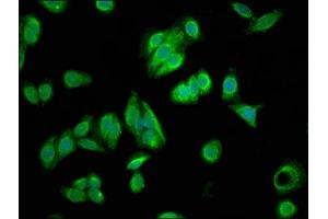 Immunofluorescence staining of HepG2 cells with ABIN7152940 at 1:166, counter-stained with DAPI. (FIL1L 抗体  (AA 1-200))