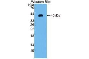 Detection of Recombinant MIP3a, Rat using Monoclonal Antibody to Macrophage Inflammatory Protein 3 Alpha (MIP3a) (CCL20 抗体  (AA 24-95))