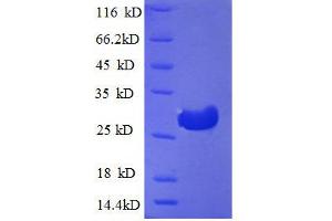 Cathepsin F (CTSF) (AA 273-484), (partial) protein (His tag)