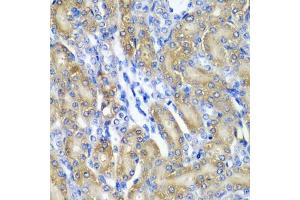 Immunohistochemistry of paraffin-embedded rat kidney using CRYAA antibody (ABIN5973354) at dilution of 1/200 (40x lens). (CRYAA 抗体)