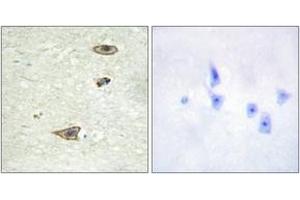 Immunohistochemistry analysis of paraffin-embedded human brain tissue, using GRK1 (Ab-21) Antibody. (GRK1 抗体  (AA 6-55))