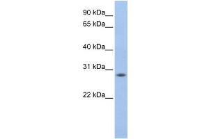 Western Blotting (WB) image for anti-MPV17 Mitochondrial Membrane Protein-Like 2 (MPV17L2) antibody (ABIN2459191) (MPV17L2 抗体)
