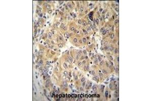 Immunohistochemistry (Paraffin-embedded Sections) (IHC (p)) image for anti-Asparaginyl-tRNA Synthetase (NARS) (AA 24-53), (N-Term) antibody (ABIN655041)