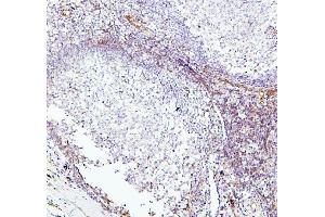 IHC analysis of TEK using anti-TEK antibody (ABIN7600762). (TEK 抗体  (AA 23-616))