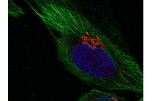 anti-Syntaxin 11 (STX11) (AA 1-15) antibody