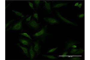 Immunofluorescence of monoclonal antibody to ATP2A1 on HeLa cell. (ATP2A1/SERCA1 抗体  (AA 522-612))