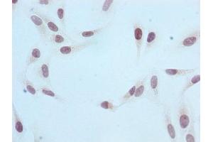 Immunocytochemistry analysis of ABIN7127304 diluted at 1:100 and staining in Hela cells performed on a Leica BondTM system. (Recombinant HIST1H3A 抗体  (H3R2me))