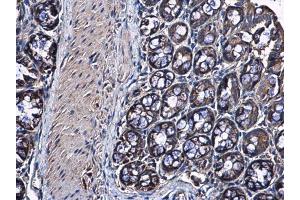 Immunohistochemistry (IHC) image for anti-Ribosomal Protein S10 (RPS10) antibody (ABIN2855193)