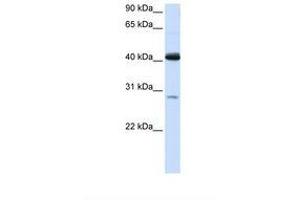 Image no. 1 for anti-Glutaryl-CoA Dehydrogenase (GCDH) (AA 146-195) antibody (ABIN6738082)