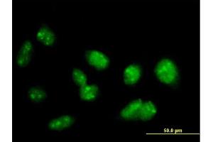 Immunofluorescence of purified MaxPab antibody to PRDM15 on HeLa cell. (PRDM15 抗体  (AA 1-1141))