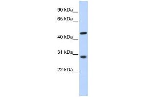 PYGO2 antibody used at 0. (PYGO2 抗体  (N-Term))