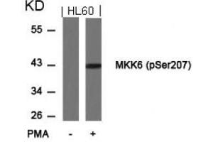 Image no. 3 for anti-Mitogen-Activated Protein Kinase Kinase 6 (MAP2K6) (pSer207) antibody (ABIN196865) (MAP2K6 抗体  (pSer207))