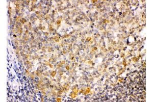 TRIB2 was detected in paraffin-embedded sections of human tonsil tissues using rabbit anti- TRIB2 Antigen Affinity purified polyclonal antibody at 1 μg/mL. (TRIB2 抗体  (Middle Region))
