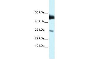WB Suggested Anti-Amhr2 Antibody   Titration: 1. (AMHR2 抗体  (N-Term))
