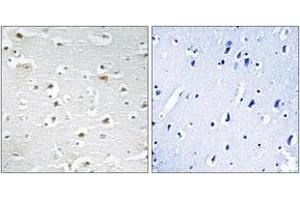 Immunohistochemistry analysis of paraffin-embedded human brain tissue, using DDX3Y Antibody. (DDX3Y 抗体  (AA 41-90))