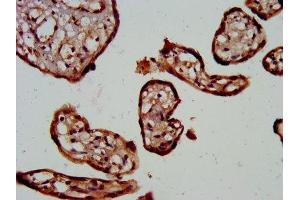 Immunohistochemistry (IHC) image for anti-Transient Receptor Potential Cation Channel, Subfamily V, Member 6 (TRPV6) (AA 620-764) antibody (ABIN7172889)