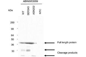 Detection of N protein. (Recombinant SARS-CoV-2 Nucleocapsid 抗体)