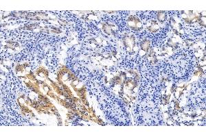 Detection of KRT6A in Human Small intestine Tissue using Monoclonal Antibody to Keratin 6A (KRT6A) (KRT6A 抗体  (AA 163-468))