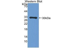 Western blot analysis of the recombinant protein. (Perforin 1 抗体  (AA 120-353))