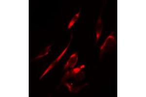 ABIN6274289 staining HeLa cells by IF/ICC. (MAPK10 抗体  (C-Term))