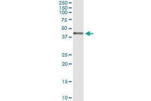 Immunoprecipitation of CTH transfected lysate using anti-CTH MaxPab rabbit polyclonal antibody and Protein A Magnetic Bead , and immunoblotted with CTH purified MaxPab mouse polyclonal antibody (B01P) . (CTH 抗体  (AA 1-405))