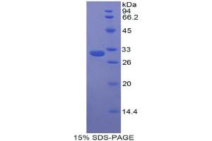 SDS-PAGE analysis of Rat CPB2/TAFI Protein.