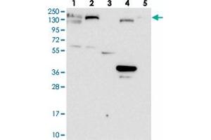 Western blot analysis of Lane 1: RT-4, Lane 2: U-251 MG, Lane 3: Human Plasma, Lane 4: Liver, Lane 5: Tonsil with GOLGA3 polyclonal antibody  at 1:100-1:250 dilution. (Golgin A3 抗体)
