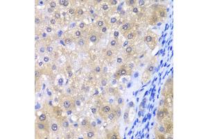 Immunohistochemistry of paraffin-embedded human liver injury using GPX4 antibody (ABIN6294188) at dilution of 1:200 (40x lens). (GPX4 抗体)