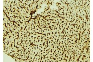 ABIN6278674 at 1/100 staining Mouse liver tissue by IHC-P. (DYRK3 抗体  (Internal Region))