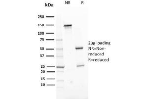 SDS-PAGE Analysis Purified ERCC1 Mouse Monoclonal Antibody (ERCC1/2318). (ERCC1 抗体  (AA 191-281))