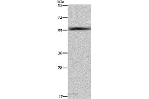 Western blot analysis of Human fetal liver tissue , using FAR2 Polyclonal Antibody at dilution of 1:1000