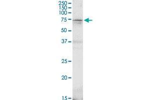 Western Blotting (WB) image for anti-Glutamate Decarboxylase 2 (Pancreatic Islets and Brain, 65kDa) (GAD2) (AA 1-585) antibody (ABIN949999)