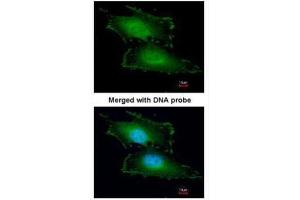 ICC/IF Image Immunofluorescence analysis of paraformaldehyde-fixed HeLa, using Peflin, antibody at 1:200 dilution. (PEF1 抗体)