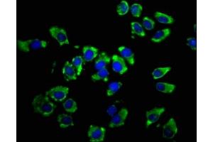 Immunofluorescence staining of A549 cells with ABIN7158393 at 1:66, counter-stained with DAPI. (LSAMP 抗体  (AA 168-287))