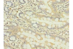 Immunohistochemistry of paraffin-embedded human small intestine tissue using ABIN7162022 at dilution of 1:100 (NUPL1 抗体  (AA 211-480))