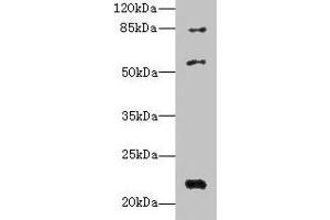 Western blot All lanes: PYHIN1 antibody at 6 μg/mL + Mouse small intestine tissue Secondary Goat polyclonal to rabbit IgG at 1/10000 dilution Predicted band size: 56, 55, 52, 51, 27, 26 kDa Observed band size: 56, 22, 84 kDa (PYHIN1 抗体  (AA 1-245))