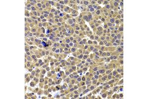 Immunohistochemistry of paraffin-embedded mouse cancer using ARID3A antibody (ABIN5975618) at dilution of 1/100 (40x lens). (ARID3A 抗体)