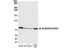Western Blotting (WB) image for anti-Aldehyde Dehydrogenase 18 Family, Member A1 (ALDH18A1) (AA 575-625) antibody (ABIN7449868) (P5CS 抗体  (AA 575-625))