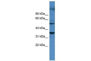 CYP11B1 antibody used at 0. (CYP11B1 抗体  (Middle Region))