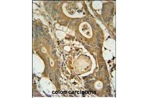 Immunohistochemistry (Paraffin-embedded Sections) (IHC (p)) image for anti-Glucosaminyl (N-Acetyl) Transferase 3, Mucin Type (GCNT3) (AA 390-418), (C-Term) antibody (ABIN654928)