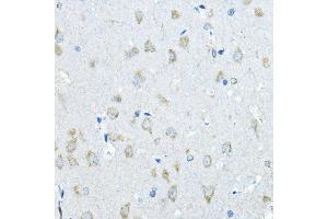 Immunohistochemistry of paraffin-embedded rat brain using IDS Rabbit pAb (ABIN3015633, ABIN3015634, ABIN3015635 and ABIN6218988) at dilution of 1:200 (40x lens). (IDS 抗体  (AA 34-290))