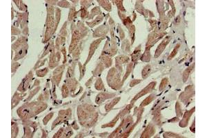 IHC analysis of paraffin-embedded human heart tissue, using P4HA1 antibody (1/100 dilution). (P4HA1 抗体  (AA 256-525))