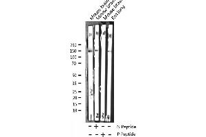 Western blot analysis of Phospho-Trk B (Tyr705) expression in various lysates (TRKB 抗体  (pTyr706))