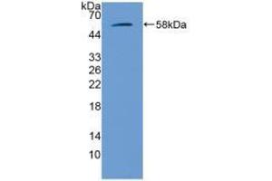 Western blot analysis of recombinant Mouse GbA. (GBA 抗体  (AA 255-509))